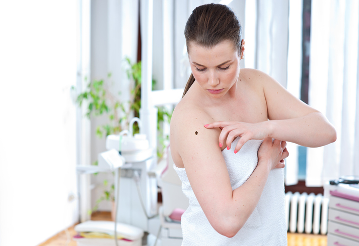 Woman examining a mole.