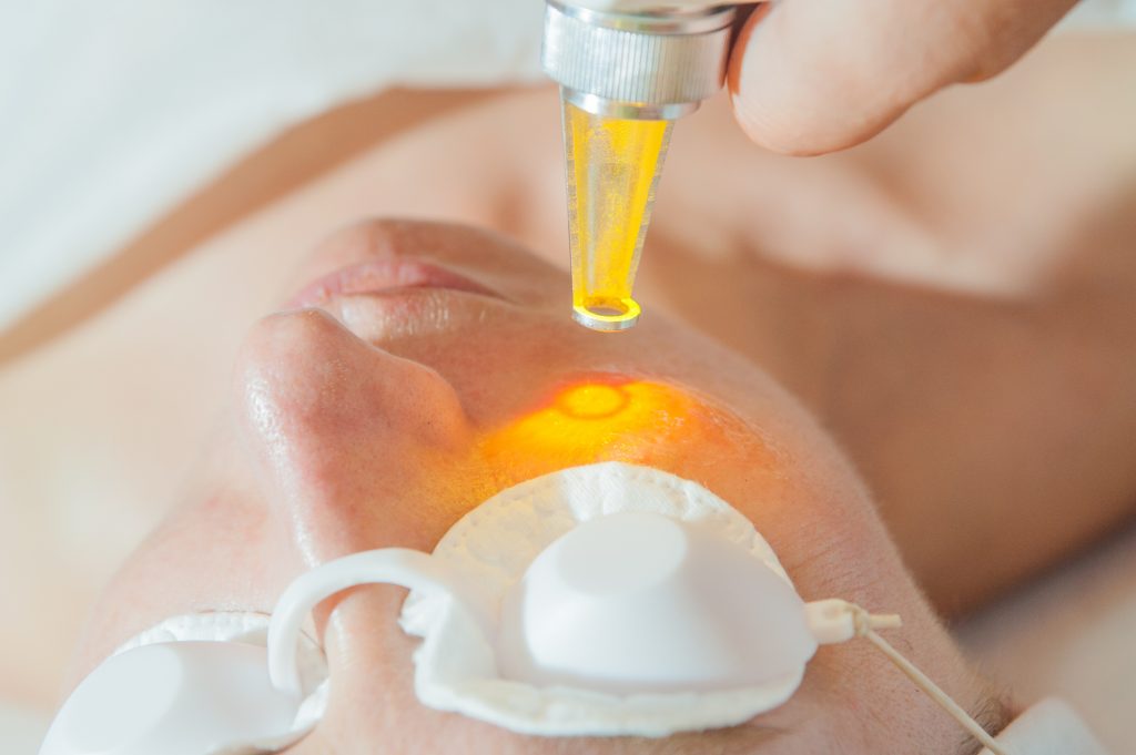 laser skin treatment