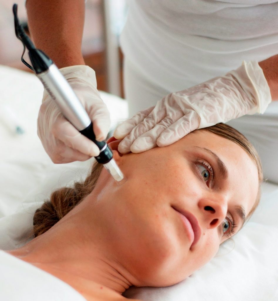 Woman receiving microneedling treatment.