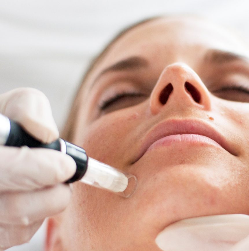 Women receiving microneedling treatment.