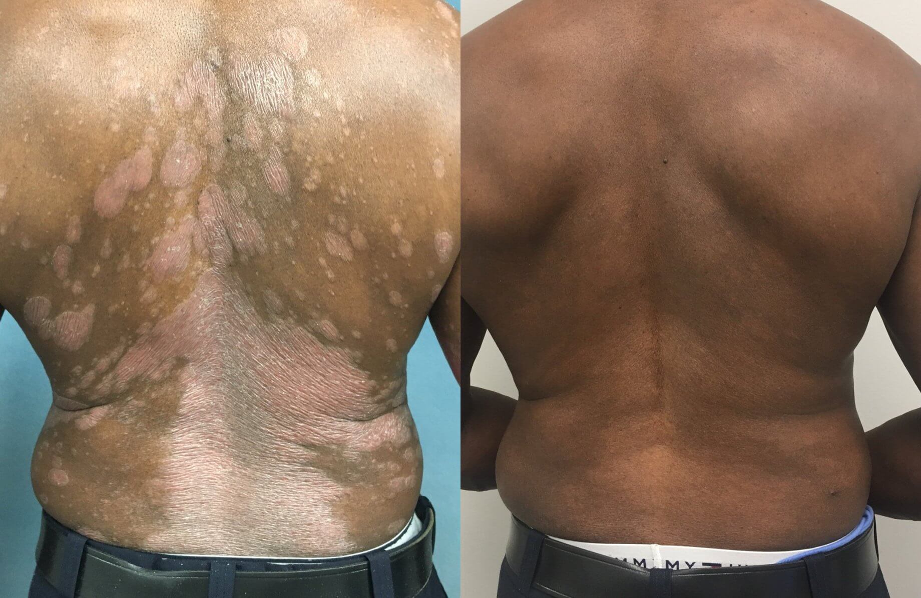 Before & After, DermAssociates Rockville