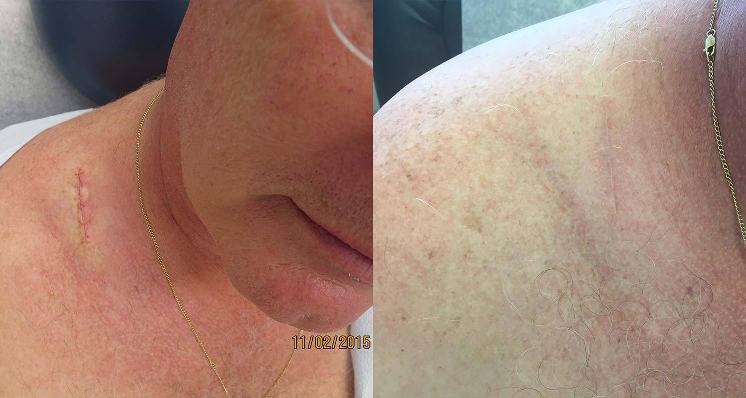 Before & After, DermAssociates Rockville