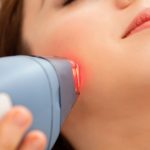 Woman receiving laser therapy.