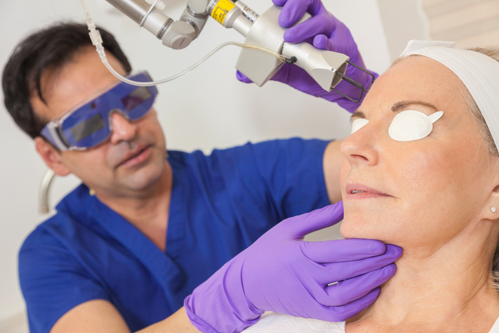 Laser skin rejuvination: Patient receiving Co2 laser treatment