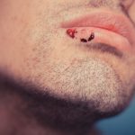 Man with cold sore before treatment