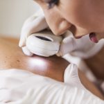 Dermatologist examining male patient's skin for signs of Squamous Cell Carcinoma.