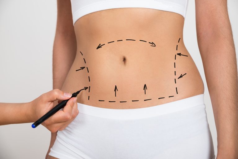 Relaxed woman during a microdermabrasion treatment.