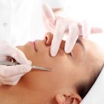 Patient undergoing dermaplaning procedure