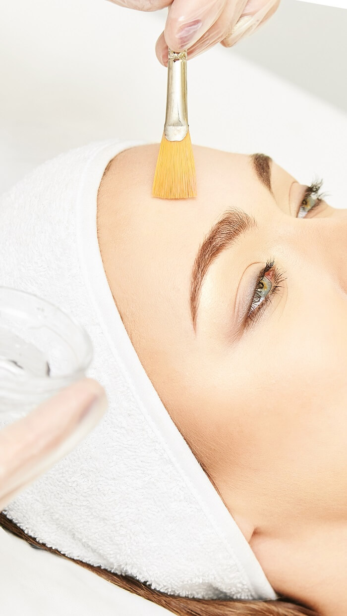 Who Is a Good Candidate for a Chemical Peel?