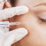 Botox is an injectable that reduces fine lines & wrinkles. It relaxes targeted muscles resulting in smoother skin with a youthful look.