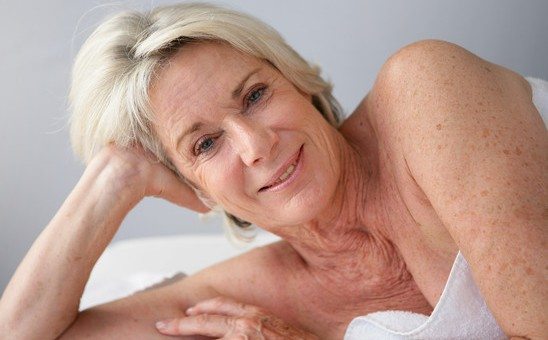 Model with Age spots and freckles
