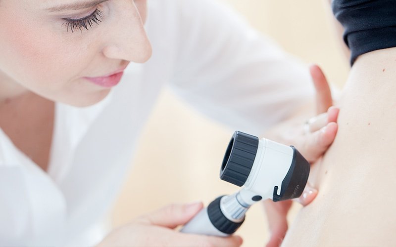 Skin Biopsy? Here Are Tips on Wound Care | Health & Fitness