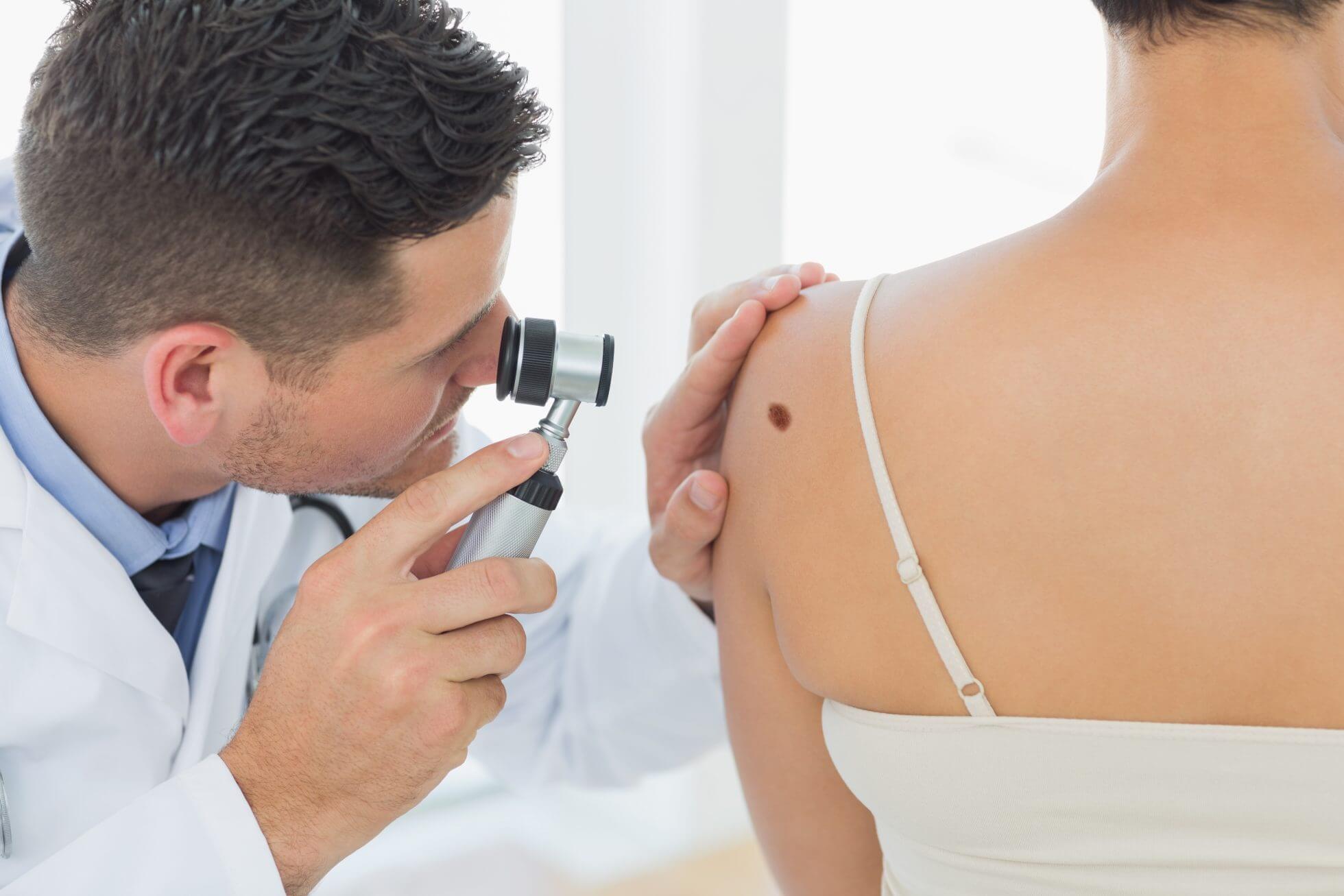 Doctor examining skin cancer on back of woman