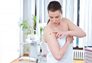 Woman checking for skin cancer