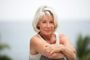 Attractive woman with Age Spots