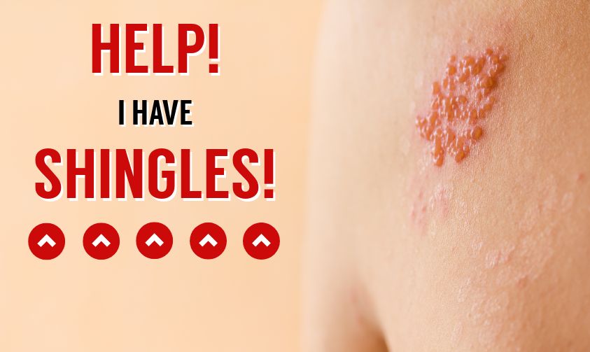 Help! I have Shingles! U.S. Dermatology Partners