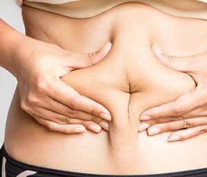 Dr. Neeraja C. Mattay at Dermatology Associates of Northern Virginia, Inc patients asking, Does CoolSculpting work?