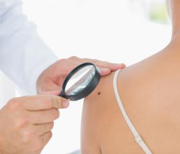 Alternative treatment with photodynamic therapy from skin cancer from dermatologist in reston, va