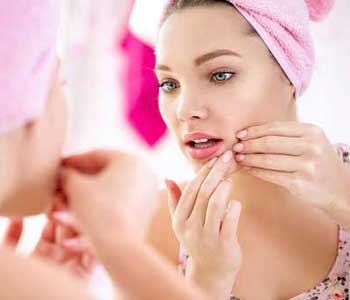 acne myths