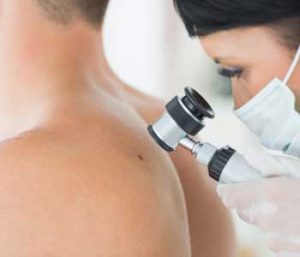 Best Time to Check Mole, Dermatology Associates of Northern Virginia, Inc