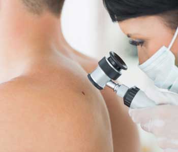 Best Time to Check Mole, Dermatology Associates of Northern Virginia, Inc