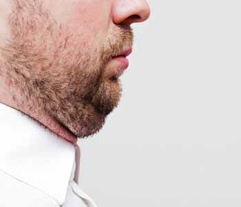 Manassas, VA area dermatologist believes Kybella double chin injections can help you