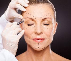 Senior Woman Being Peeped for Plastic Surgery