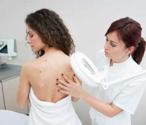 How to Remove Moles Dermatology Associates of Northern Virginia, Inc