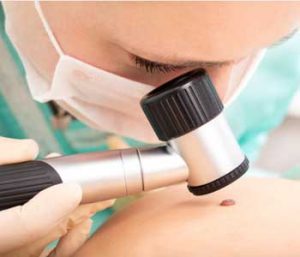 Removal Methods of a Mole, Dermatology Associates of Northern Virginia, Inc