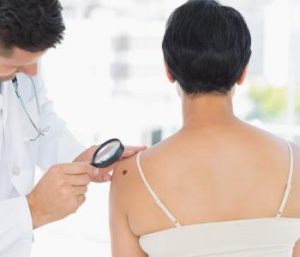 sterling area skin cancer experts describe skin cancer