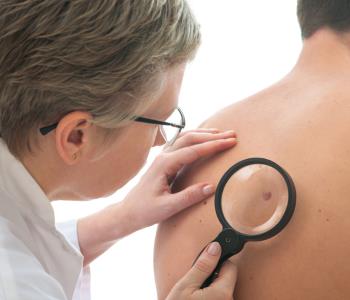 guide from sterling, va doctor to identify the signs of skin cancer
