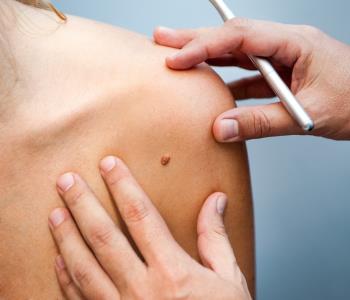 skin cancer treatments from dermatology in ashburn