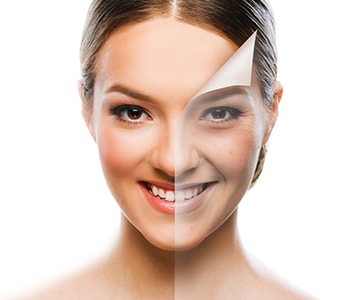 Skin Peel Treatment Centreville