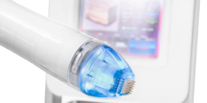 A close-up of a microneedling device with a blue tip, used for skin treatments, against a blurred screen.