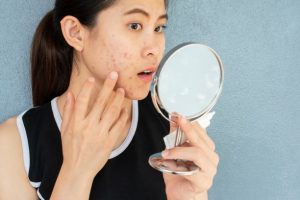 Woman with skin under stress