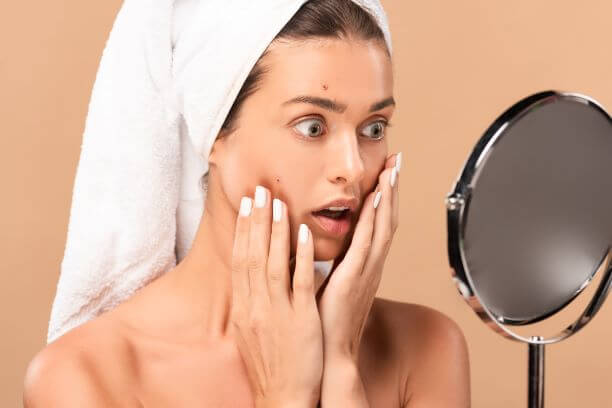 Woman looking in the mirror at stress breakouts