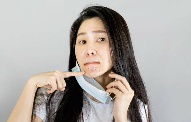 Woman with perioral dermatitis from mask wear