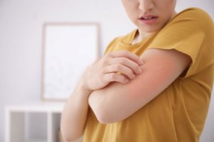 Woman scratching eczema on arm