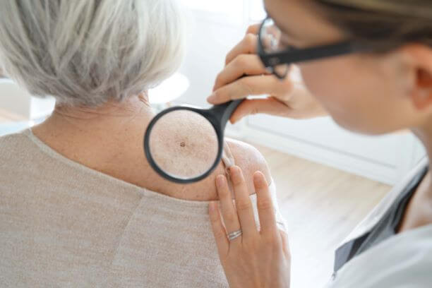 Checking for actinic keratosis and seborrheic keratosis on woman's back