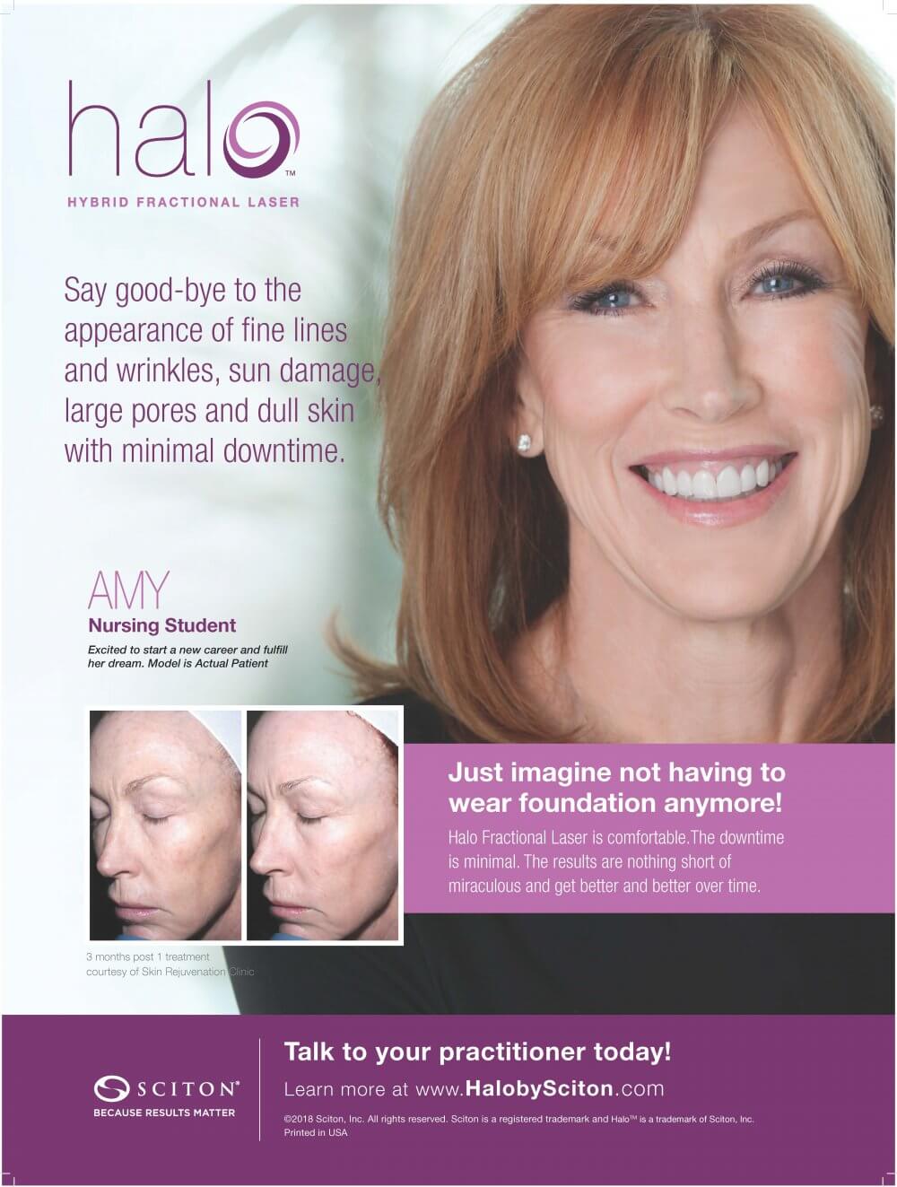 Who is a Good Candidate for HALO Laser Resurfacing