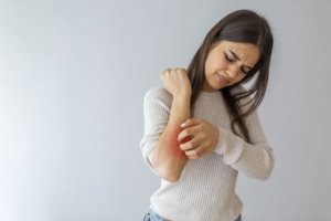 Woman scratching skin allergies