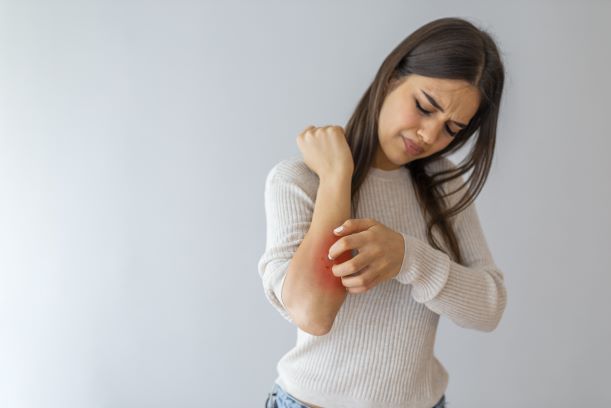 Woman scratching skin allergies