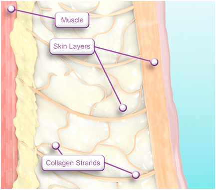 Thermage FLX | Skin Tightening