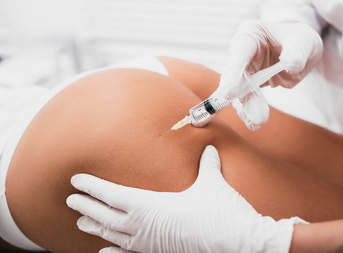 How is QWO Cellulite Removal Treatment Performed?