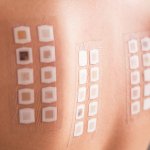 Allergy Patch Testing is a treatment used to diagnose any form of contact dermatitis and determine which allergens affect the skin.