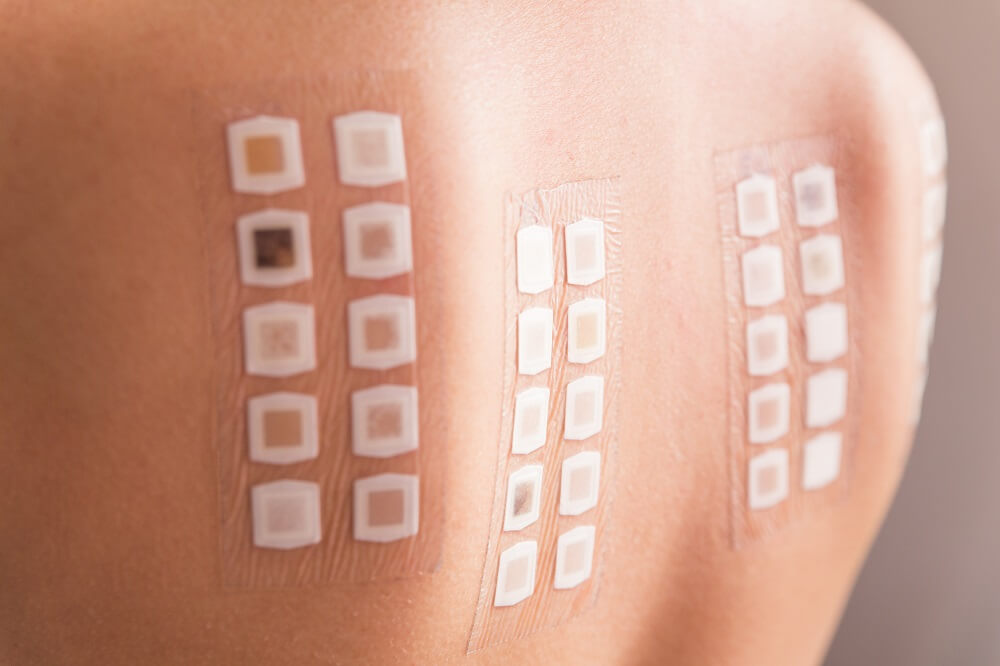 Allergy Patch Testing is a treatment used to diagnose any form of contact dermatitis and determine which allergens affect the skin.