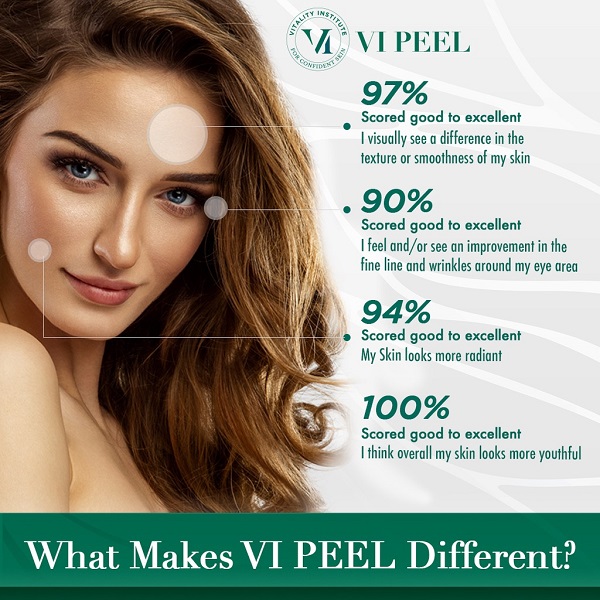 10 Things to Expect After Your First Chemical Peel - U.S. Dermatology  Partners