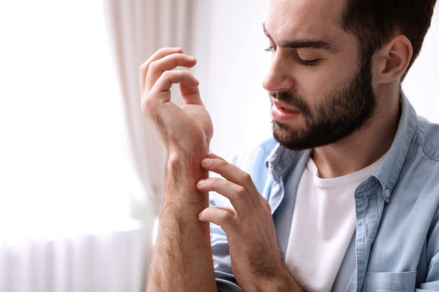 man with eczema on arm