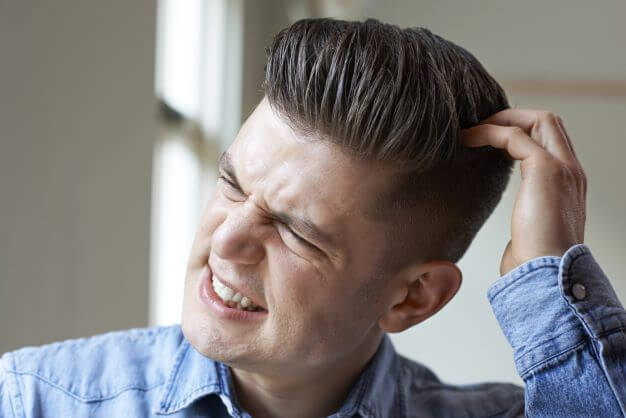 man with scalp eczema