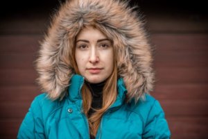 Woman with winter acne